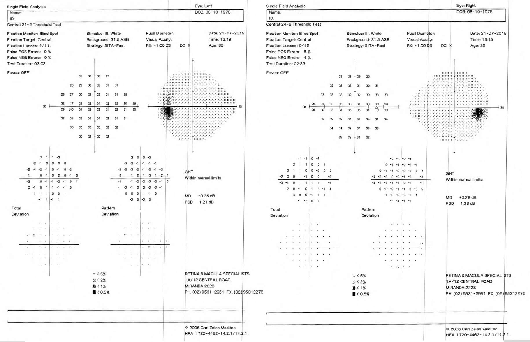 Restoration of normal visual fields, 3 months after commencement of acetazolamide (Diamox).